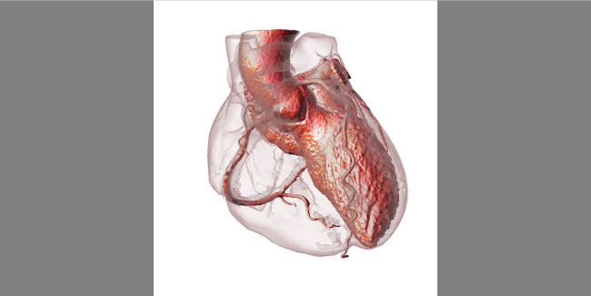 Immagine di un cuore, elaborata da dati di una scannerizzazione MRI. (Immagine: Smithsonian.com)