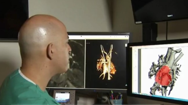 Un cardiochirurgo del Nicklaus Children’s Hospital. (Foto: WNDU.com)